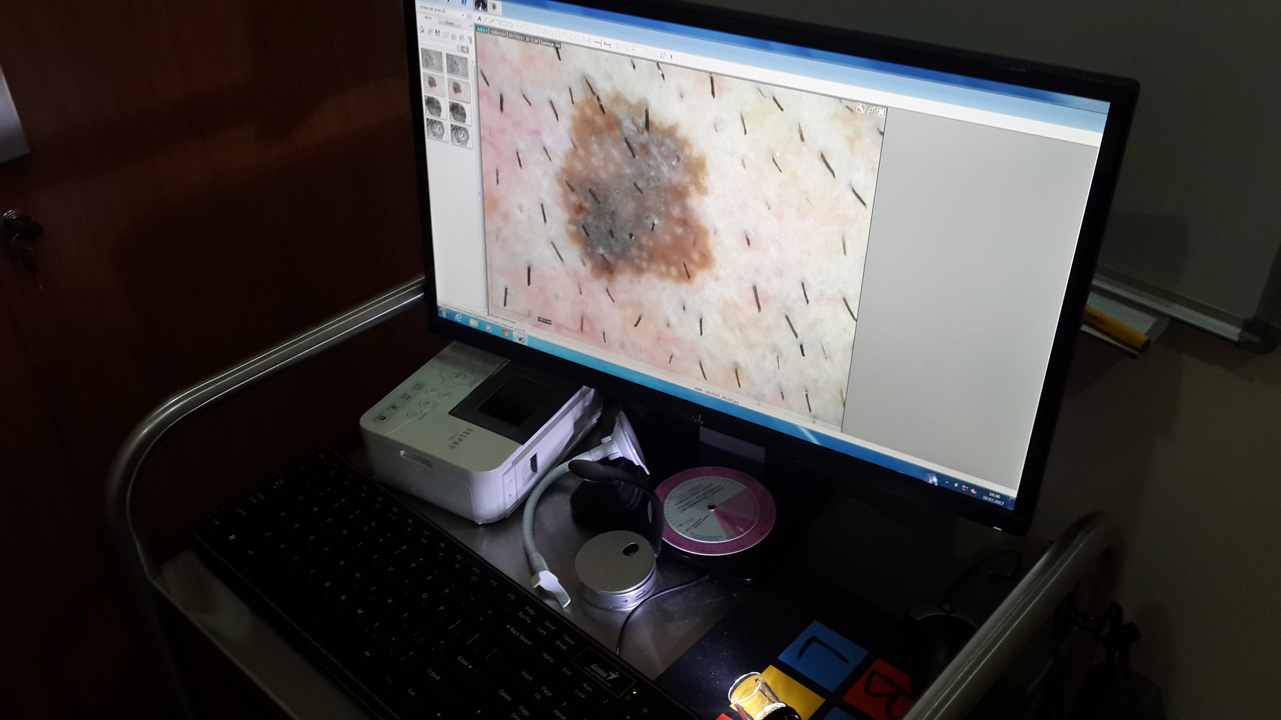 Best diagnoistic and endoscopic examinations in Armenia ENDOVISION